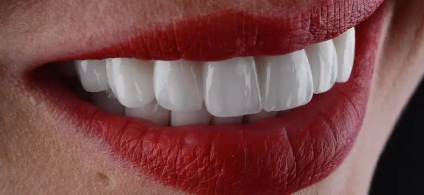 PEARLY TRANSLUCENT
